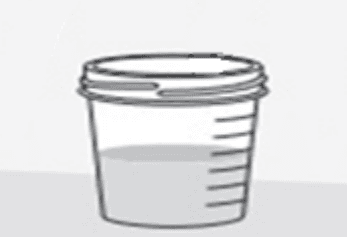 Urine opvangen in plastic beker