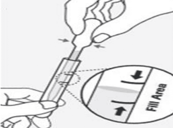 Vloeistofniveau controleren tussen zwarte markeringen