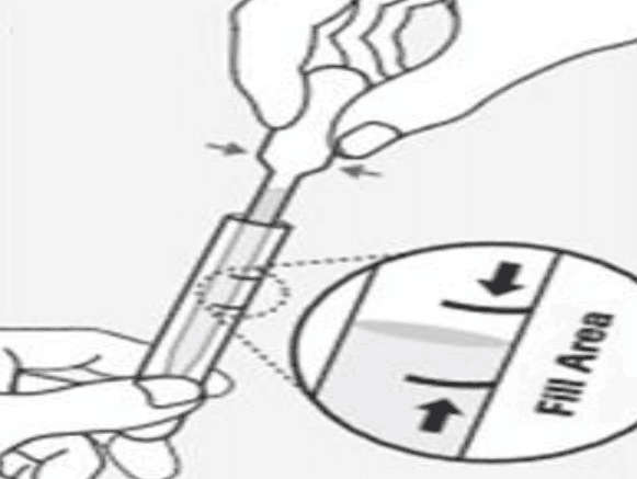 Checking fluid level between black markings