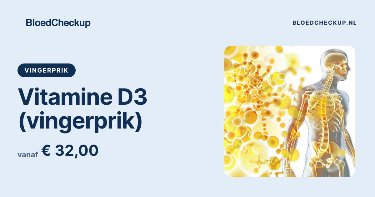bloedcheckup.nl